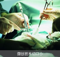 微创手术过程中